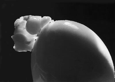 M.Pavin. The Protein Eruption